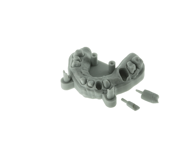 3D BUSINESS D7 DLP. Esempio di stampa arcata inferiore e denti